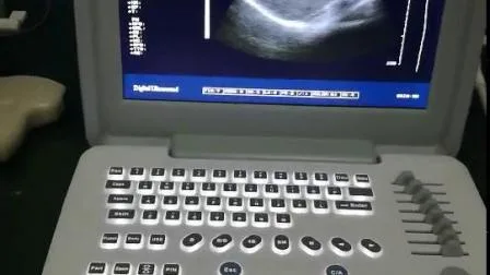 Больничный черно-белый цифровой портативный ультразвуковой сканер для гинекологии