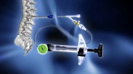 Медицинские ортопедические инструменты для малоинвазивной хирургии позвоночника Dragon Crown
